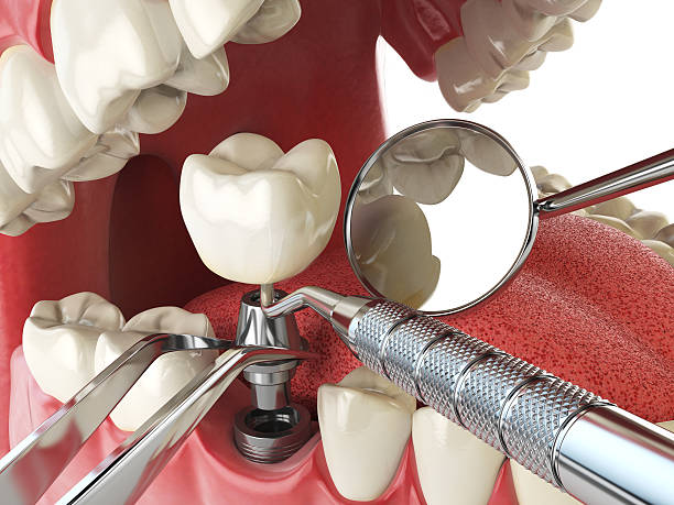 Best Walk-In Emergency Dental Services in Roseville, OH